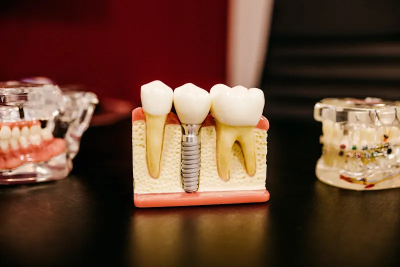 Dental Baires | Laboratorio Dental Madrid